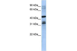 WB Suggested Anti-MSI2 Antibody Titration:  0.