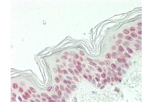 Formalin-fixed and paraffin-embedded H. (Cyclin D3 antibody  (C-Term))