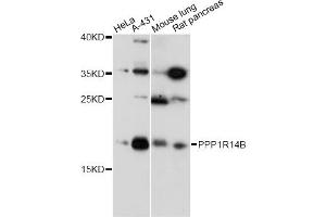 Western blot analysis of extracts of various cell lines, using PPP1R14B antibody (ABIN6294069) at 1:1000 dilution. (PPP1R14B antibody)