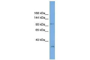 WB Suggested Anti-DENND1A Antibody Titration: 0. (DENND1A antibody  (N-Term))
