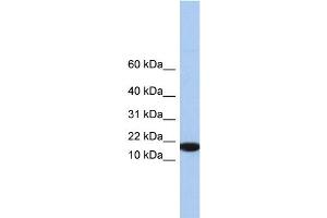 WB Suggested Anti-IL5 Antibody Titration: 0. (IL-5 antibody  (Middle Region))