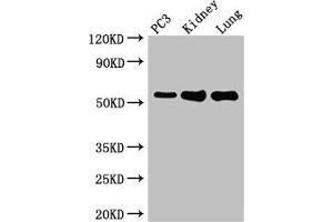 Western Blot Positive WB detected in: PC-3 whole cell lysate, Mouse kidney tissue, Mouse lung tissue All lanes: MMP13 antibody at 2 μg/mL Secondary Goat polyclonal to rabbit IgG at 1/50000 dilution Predicted band size: 54 kDa Observed band size: 54 kDa (MMP13 antibody  (AA 104-471))