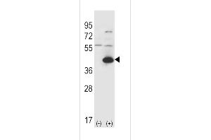 Western blot analysis of GOT1 (arrow) using rabbit polyclonal GOT1 Antibody (C-term) (ABIN650770 and ABIN2839551). (GOT1 antibody  (C-Term))
