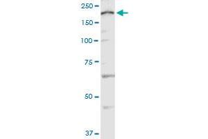 CACNA1C polyclonal antibody (A01). (CACNA1C antibody  (AA 2039-2138))