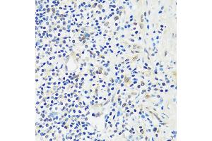 Immunohistochemistry (IHC) image for anti-Achaete-Scute Complex Homolog 4 (ASCL4) (AA 1-172) antibody (ABIN7265374)