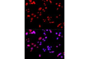 Immunofluorescence analysis of GFP-RNF168 transgenic U2OS cells using RPA2 antibody. (RPA2 antibody)