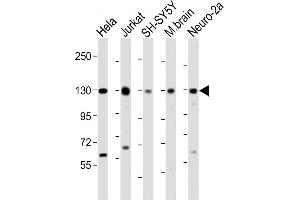 All lanes : Anti-DBN1 Antibody (Center) at 1:2000 dilution Lane 1: Hela whole cell lysate Lane 2: Jurkat whole cell lysate Lane 3: SH-SY5Y whole cell lysate Lane 4: mouse brain lysate Lane 5: Neuro-2a whole cell lysate Lysates/proteins at 20 μg per lane. (DBN1 antibody  (AA 194-228))