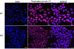 anti-Replication Protein A1, 70kDa (RPA1) antibody