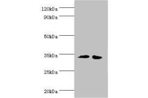 Western blot All lanes: RPH3AL antibody at 12 μg/mL Lane 1: LO2 whole cell lysate Lane 2: K562 whole cell lysate Secondary Goat polyclonal to rabbit IgG at 1/10000 dilution Predicted band size: 35, 32 kDa Observed band size: 35 kDa (RPH3AL antibody  (AA 161-315))
