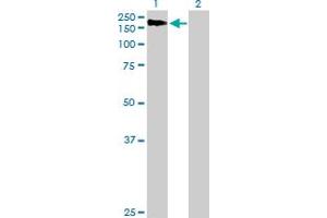 Western Blot analysis of AGL expression in transfected 293T cell line by AGL MaxPab polyclonal antibody. (AGL antibody  (AA 1-1532))