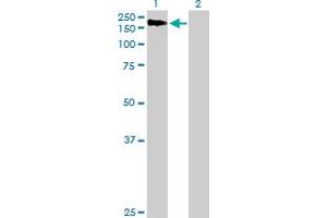 Western Blot analysis of AGL expression in transfected 293T cell line by AGL MaxPab polyclonal antibody.