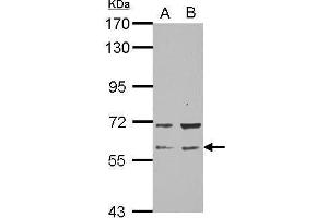 WB Image Sample (30 ug of whole cell lysate) A: NT2D1 B: PC-3 7. (RAP1GDS1 antibody  (N-Term))