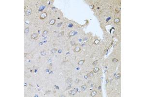 Immunohistochemistry of paraffin-embedded rat brain using RARA antibody (ABIN5970142) at dilution of 1/100 (40x lens). (Retinoic Acid Receptor alpha antibody)