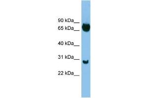 WB Suggested Anti-SOX13 Antibody Titration: 0. (SOX13 antibody  (Middle Region))