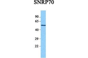 Host:  Rabbit  Target Name:  SNRP70  Sample Tissue:  Human Hela  Antibody Dilution:  1. (SNRNP70 antibody  (C-Term))