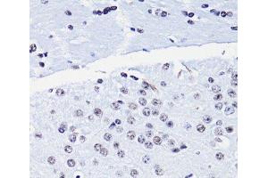 Immunohistochemistry of paraffin-embedded Mouse brain using Acetyl-Histone H4-K8 Polyclonal Antibody at dilution of 1:100 (40x lens). (Histone H4 antibody  (acLys8))