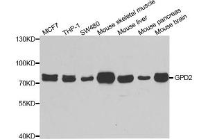 Western blot analysis of extracts of various cell lines, using GPD2 antibody (ABIN5973974) at 1/1000 dilution. (GPD2 antibody)