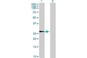 Western Blot analysis of PRSS2 expression in transfected 293T cell line by PRSS2 MaxPab polyclonal antibody. (PRSS2 antibody  (AA 1-247))