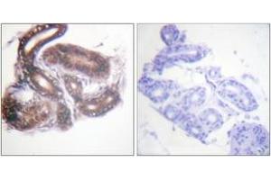 Immunohistochemistry analysis of paraffin-embedded human skin tissue, using HDAC3 (Ab-424) Antibody. (HDAC3 antibody  (AA 379-428))