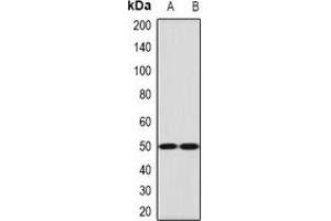 Western blot analysis of Ephrin B2 expression in mouse lung (A), mouse brain (B) whole cell lysates. (Ephrin B2 antibody)