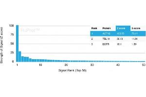 Analysis of Protein Array containing more than 19,000 full-length human proteins using Sarcomeric Actinin Alpha 2 Mouse Monoclonal Antibody (ACTN2/3293). (ACTN2 antibody  (AA 557-692))