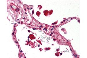 Anti-STAT1 antibody IHC of human lung. (STAT1 antibody)