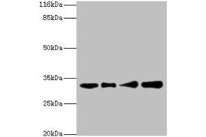 Western blot All lanes: RSU1 antibody at 2 μg/mL Lane 1: Human placenta tissue Lane 2: Caco-2 whole cell lysate Lane 3: Jurkat whole cell lysate Lane 4: HepG2 whole cell lysate Secondary Goat polyclonal to rabbit IgG at 1/10000 dilution Predicted band size: 32, 26 kDa Observed band size: 32 kDa (RSU1 antibody  (AA 117-277))