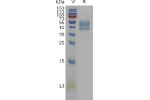 Human IL13(35-146) Protein, hFc Tag on SDS-PAGE under reducing condition. (IL-13 Protein (AA 35-146) (Fc Tag))