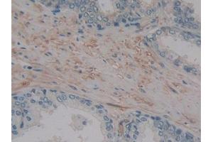 DAB staining on IHC-P; Samples: Human Prostate Tissue (MMP14 antibody  (AA 322-541))
