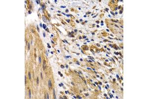 Immunohistochemistry of paraffin-embedded human normal colon using HSPB8 antibody (ABIN5971347) at dilution of 1/200 (40x lens).