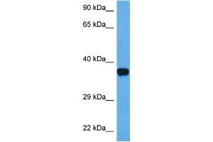 Western Blotting (WB) image for anti-Nucleophosmin (Nucleolar phosphoprotein B23, Numatrin) (NPM1) (N-Term) antibody (ABIN2778260)