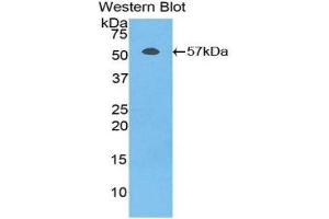 Western Blotting (WB) image for anti-Fibrinogen beta Chain (FGB) (AA 49-495) antibody (ABIN1078030)