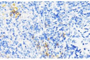 Immunohistochemistry of paraffin-embedded Mouse spleen using CAMP Polyclonal Antibody at dilution of 1:200 (40x lens). (Cathelicidin antibody)