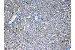 Immunohistochemistry (IHC) image for anti-Fms-Related tyrosine Kinase 3 (FLT3) (AA 62-295) antibody (ABIN5518988)
