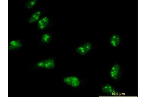 Immunofluorescence of monoclonal antibody to TASP1 on HeLa cell. (TASP1 antibody  (AA 1-420))
