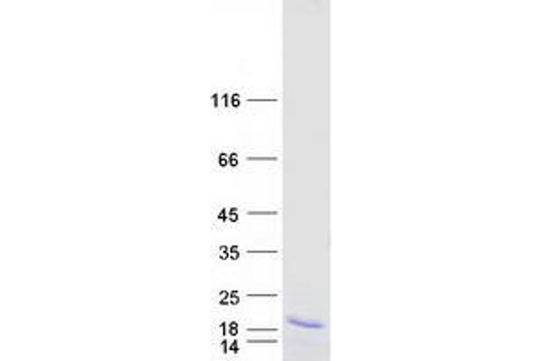 DPH3 Protein (Transcript Variant 1) (Myc-DYKDDDDK Tag)