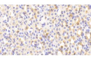 Detection of NFE2L2 in Rat Stomach Tissue using Polyclonal Antibody to Nuclear Factor, Erythroid Derived 2 Like Protein 2 (NFE2L2) (NRF2 antibody  (AA 382-604))