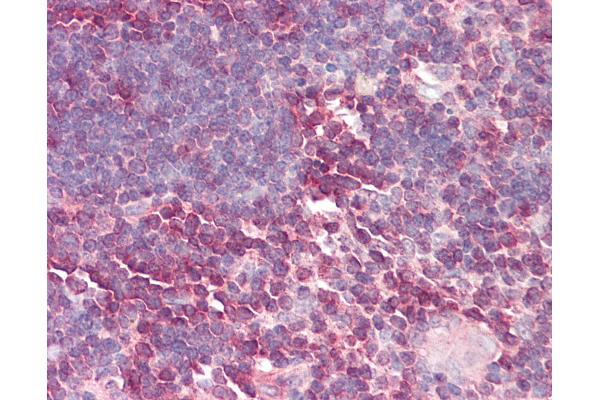 Lamin B Receptor antibody  (AA 503-552)