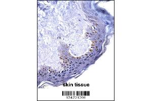 HOXC4 Antibody immunohistochemistry analysis in formalin fixed and paraffin embedded human skin tissue followed by peroxidase conjugation of the secondary antibody and DAB staining. (HOXC4 antibody  (C-Term))