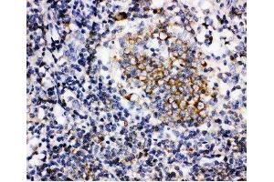 Anti-BAFF antibody, IHC(P) IHC(P): Human Tonsil Tissue (BAFF antibody  (C-Term))