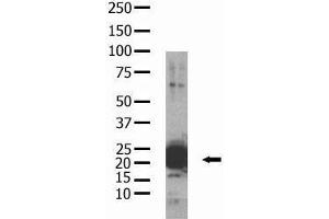 Western Blotting (WB) image for anti-BCL2-Associated Agonist of Cell Death (BAD) (pSer118), (pSer155) antibody (ABIN356355) (BAD antibody  (pSer118, pSer155))