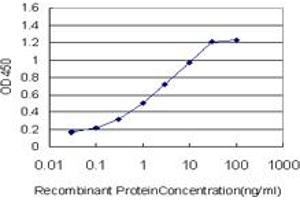 Detection limit for recombinant GST tagged PGR is approximately 0. (Progesterone Receptor antibody  (AA 1-110))