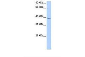 Image no. 1 for anti-Nudix (Nucleoside Diphosphate Linked Moiety X)-Type Motif 17 (NUDT17) (AA 168-217) antibody (ABIN6739464) (NUDT17 antibody  (AA 168-217))