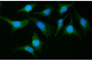 IF analysis of GIT1 using anti-GIT1 antibody (ABIN7601683). (GIT1 antibody  (AA 415-736))
