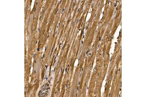 Immunohistochemistry of paraffin-embedded rat heart using R Rabbit pAb (ABIN6133143, ABIN6146576, ABIN6146578 and ABIN6224057) at dilution of 1:100 (40x lens). (RAB35 antibody  (AA 1-201))