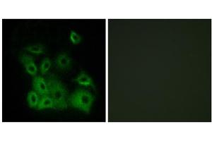 Immunofluorescence analysis of A549 cells, using BAX (Phospho-Thr167) antibody.