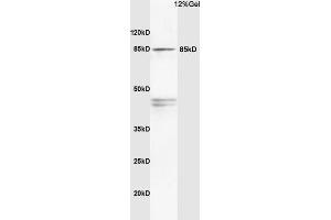 Rat brain lysates probed with Anti PI3K/PI3 kinase p85 alpha subunit Polyclonal Antibody, Unconjugated (ABIN725405) at 1:200 in 4 °C. (PIK3R1 antibody  (AA 501-600))
