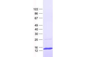 Validation with Western Blot (IFI27L2 Protein (His tag))
