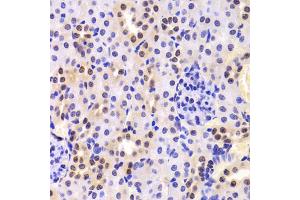 Immunohistochemistry of paraffin-embedded mouse kidney using HNRNPA1 Antibody (ABIN5975570) at dilution of 1/100 (40x lens). (HNRNPA1 antibody)