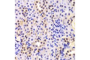 Immunohistochemistry of paraffin-embedded mouse kidney using HNRNPA1 Antibody (ABIN5975570) at dilution of 1/100 (40x lens).